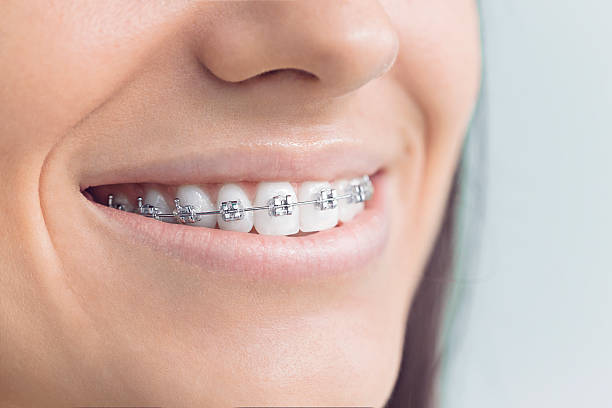 Dental Inlays and Onlays in Progress, PA